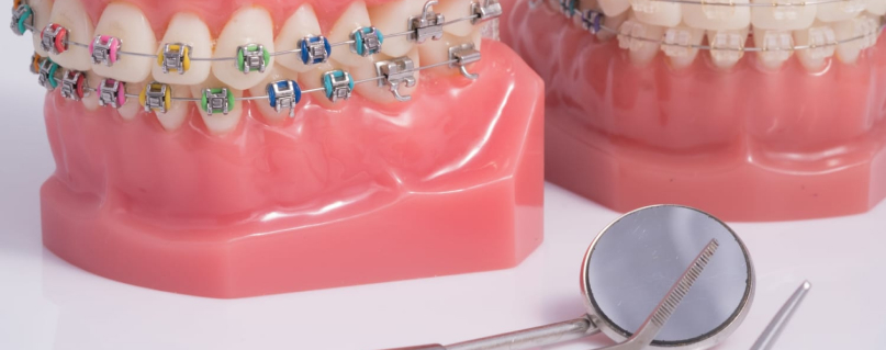 ORTHODONTIE ADOLESCENT